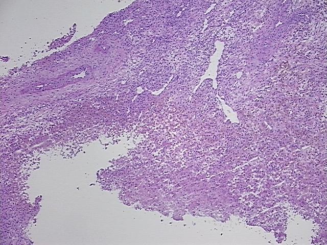 4x Image