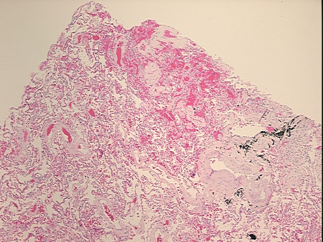 4x Image