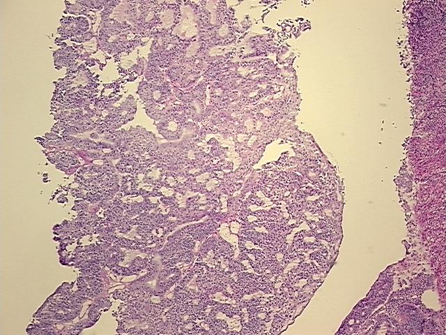 4x Image