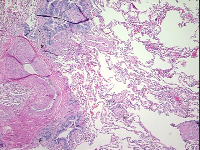 4x Image
