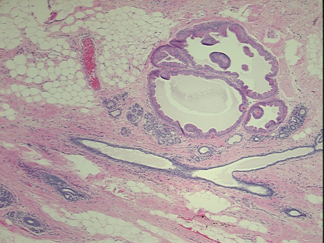 4x Image