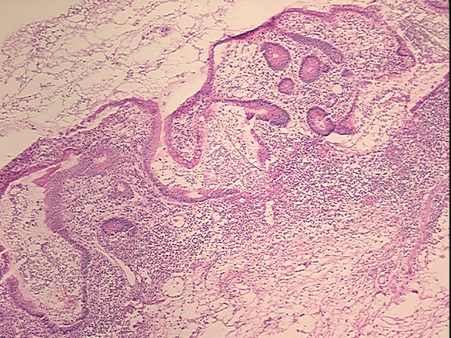 4x Image