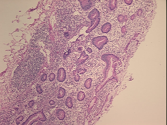 4x Image