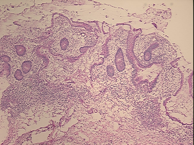 4x Image