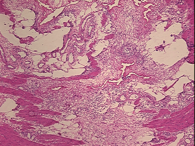 4x Image