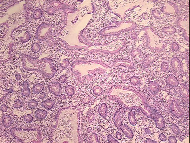 4x Image