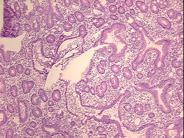 4x Image