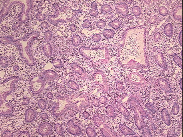 4x Image