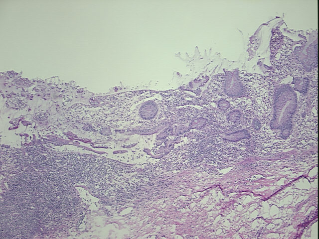 4x Image