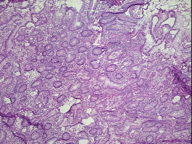 4x Image