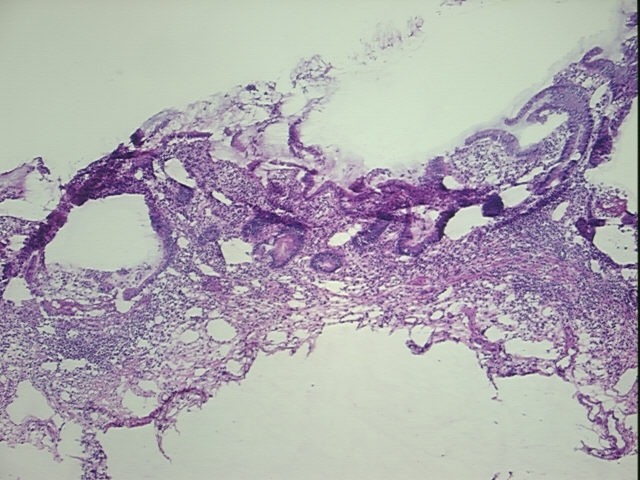4x Image