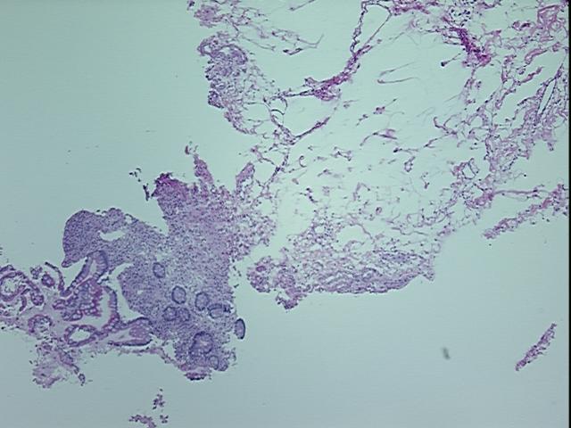 4x Image