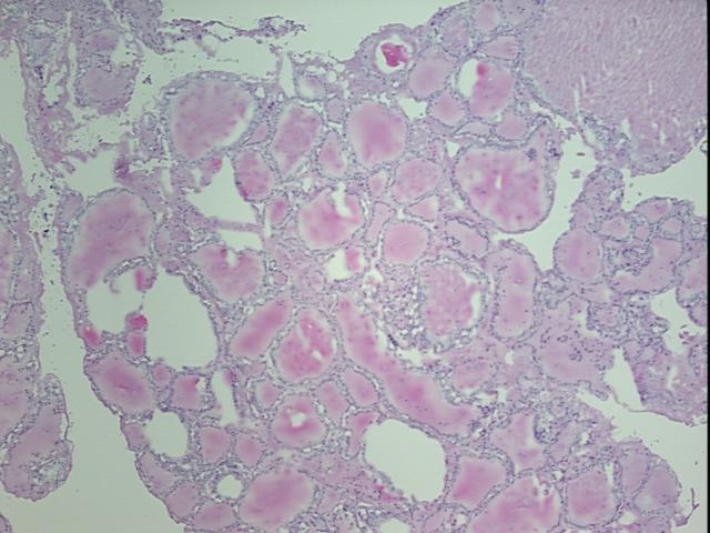 4x Image