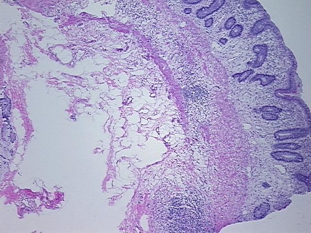 4x Image