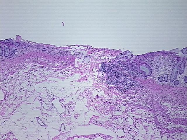 4x Image