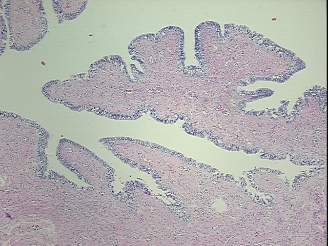 4x Image