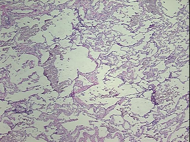 4x Image