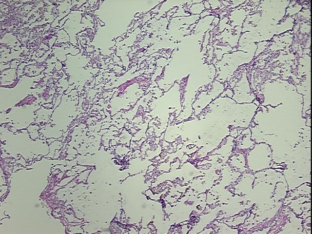 4x Image