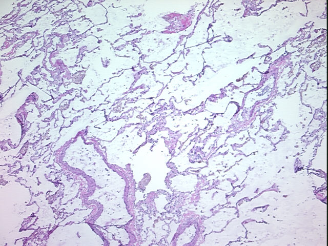 4x Image