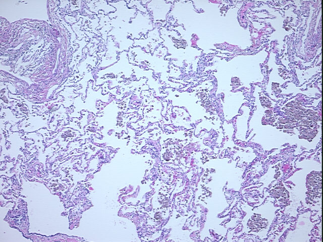 4x Image