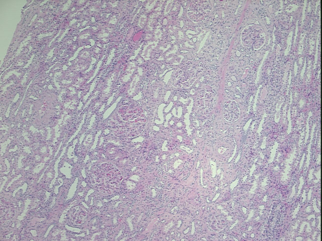 4x Image