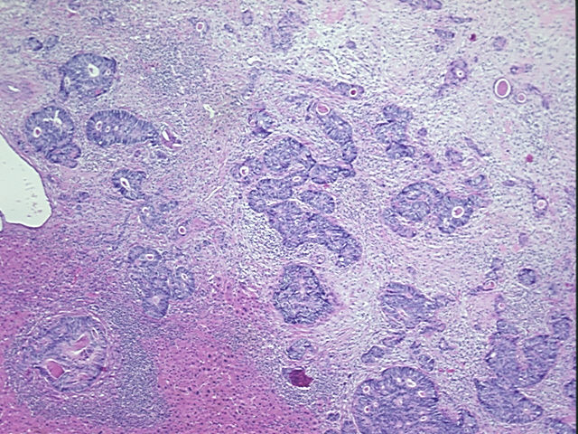 4x Image
