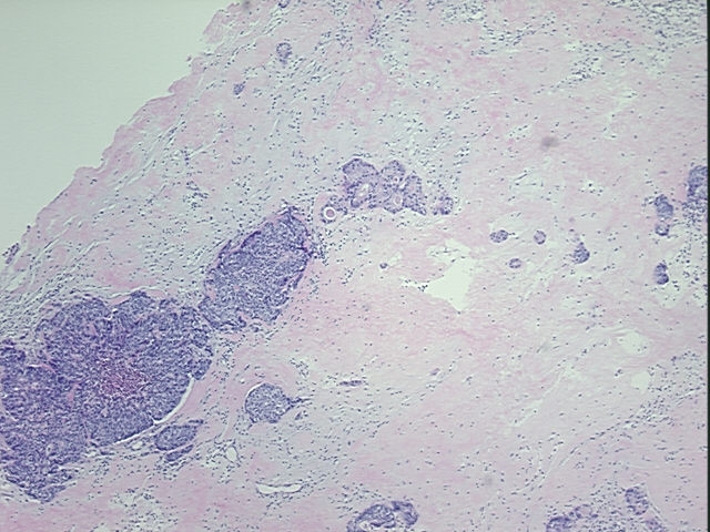 4x Image