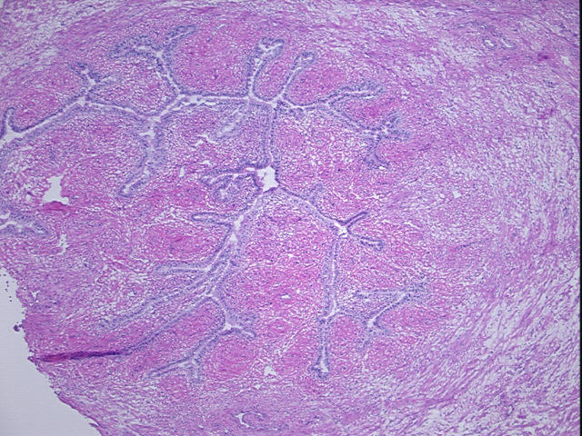 4x Image