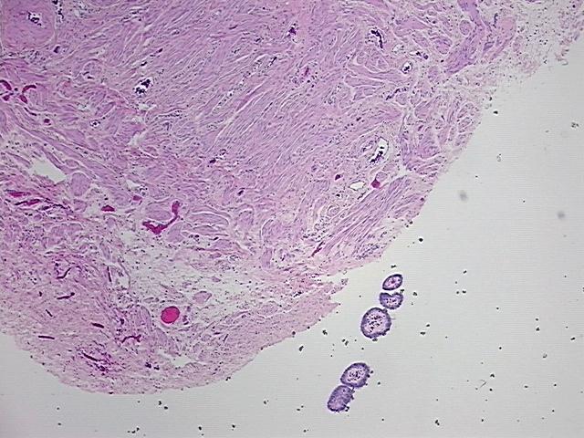 4x Image