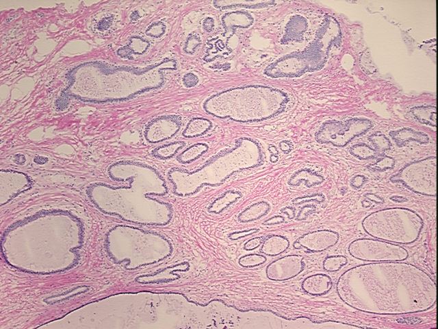 4x Image
