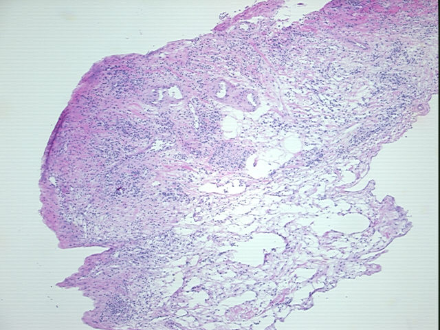 4x Image
