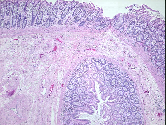 4x Image