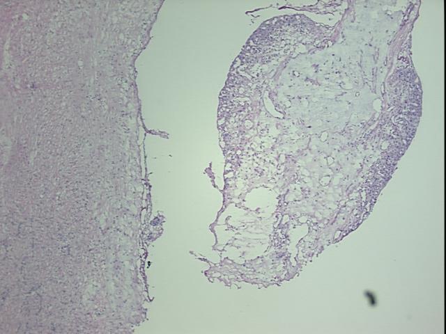 4x Image