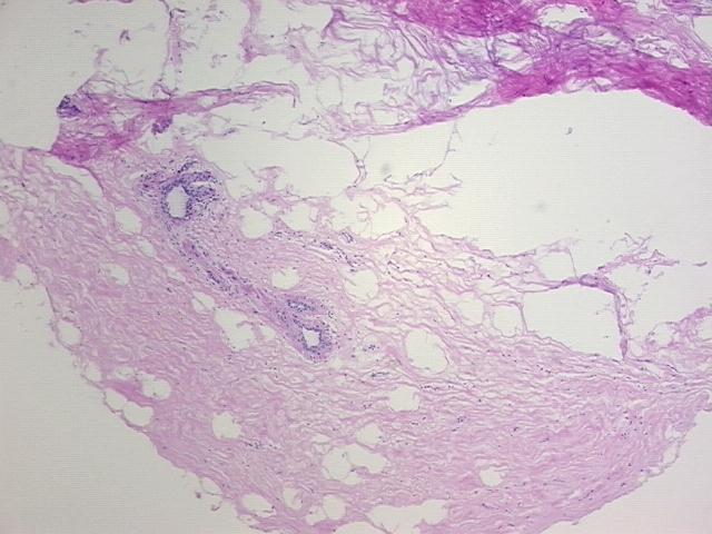4x Image