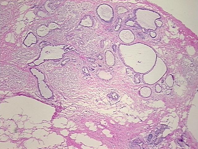 4x Image