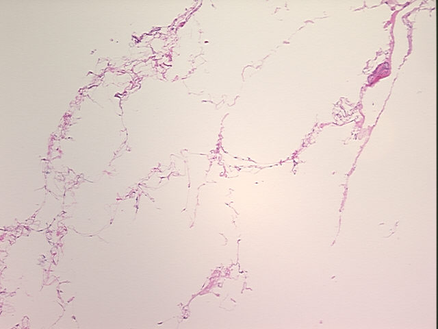 4x Image