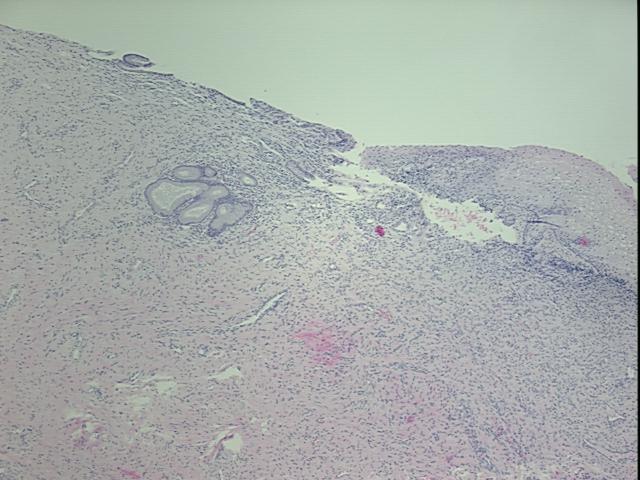 4x Image