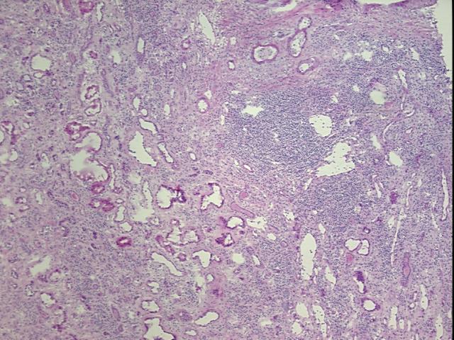 Frozen Tissue Sections, Kidney