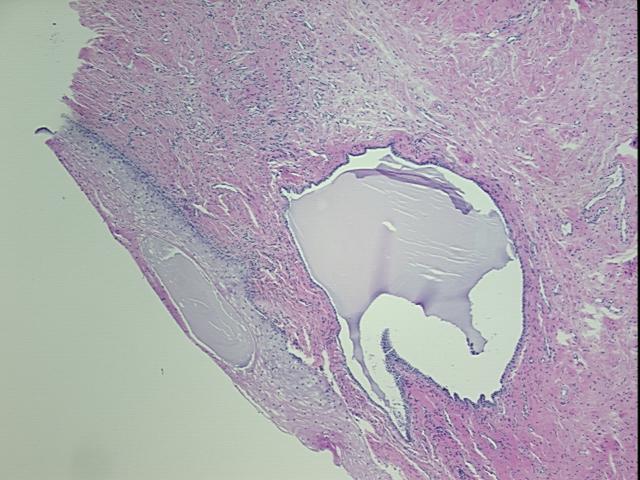 4x Image