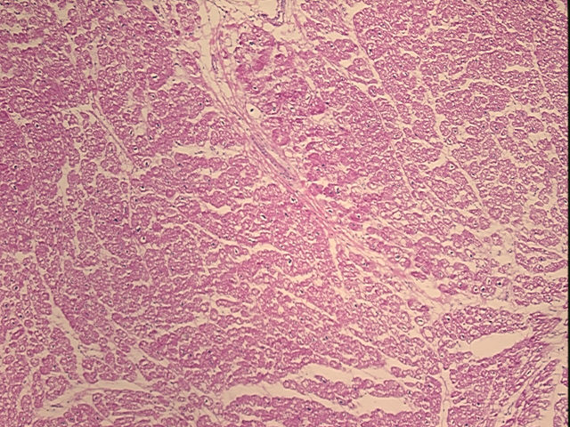 4x Image