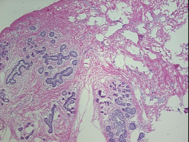 4x Image