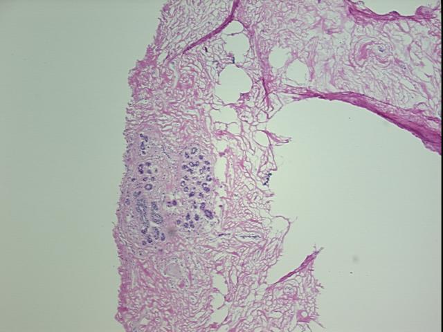 4x Image