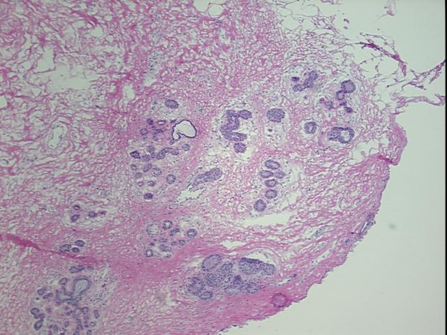 4x Image