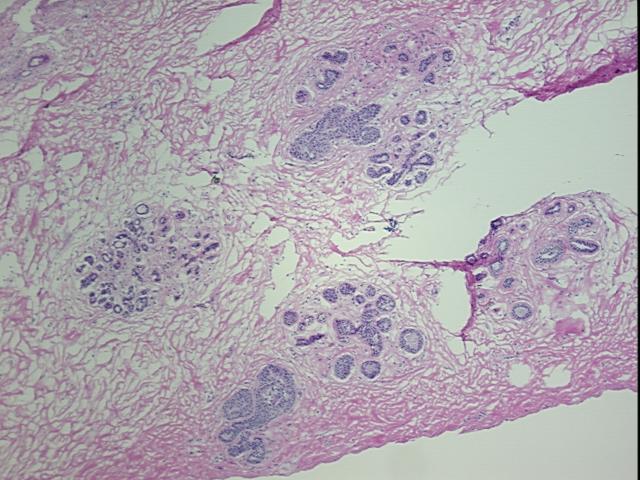 4x Image