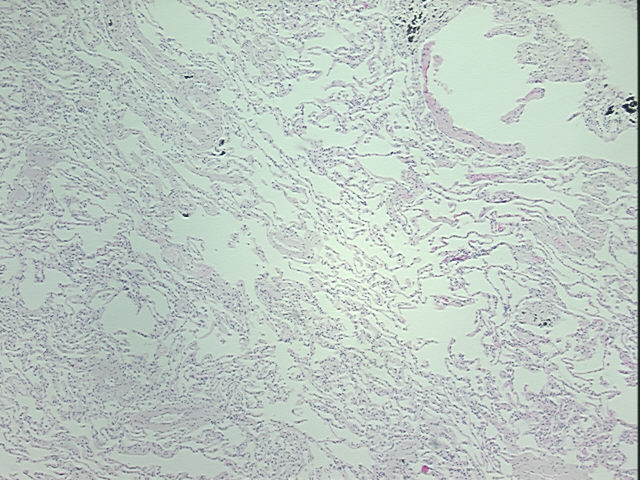4x Image