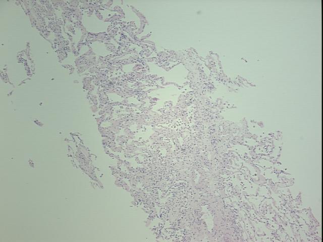 4x Image