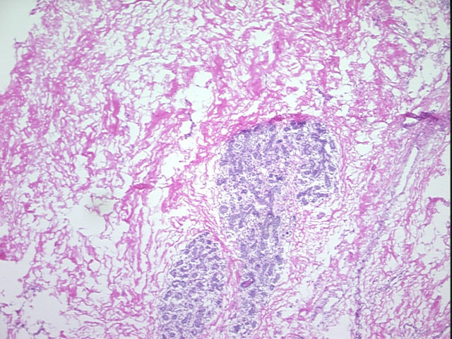 4x Image