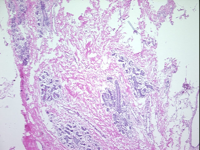 4x Image