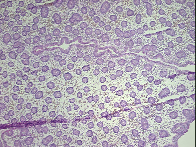 4x Image
