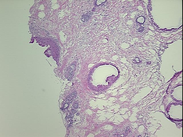 4x Image